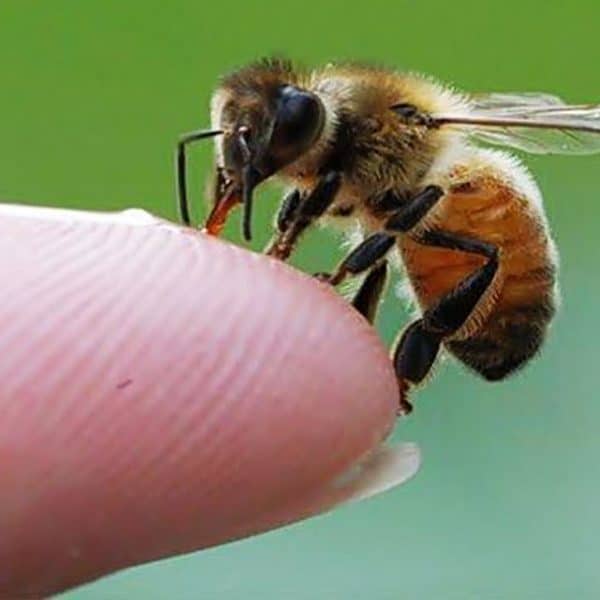 درمان خانگی نیش زنبور عسل